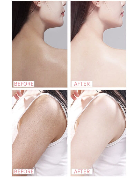 SkinLumy™ Exfoliating Whitening Cream (Pack of 2)